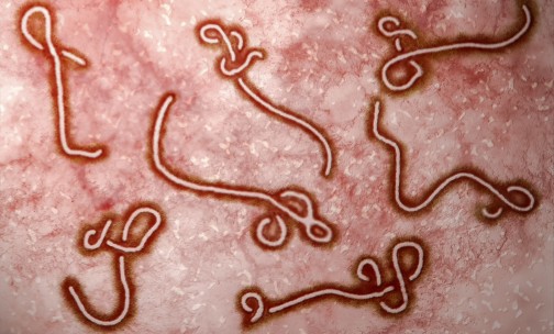 http://www.adjacentgovernment.co.uk/research-science-innovation-news/eu-boost-ebola-research/